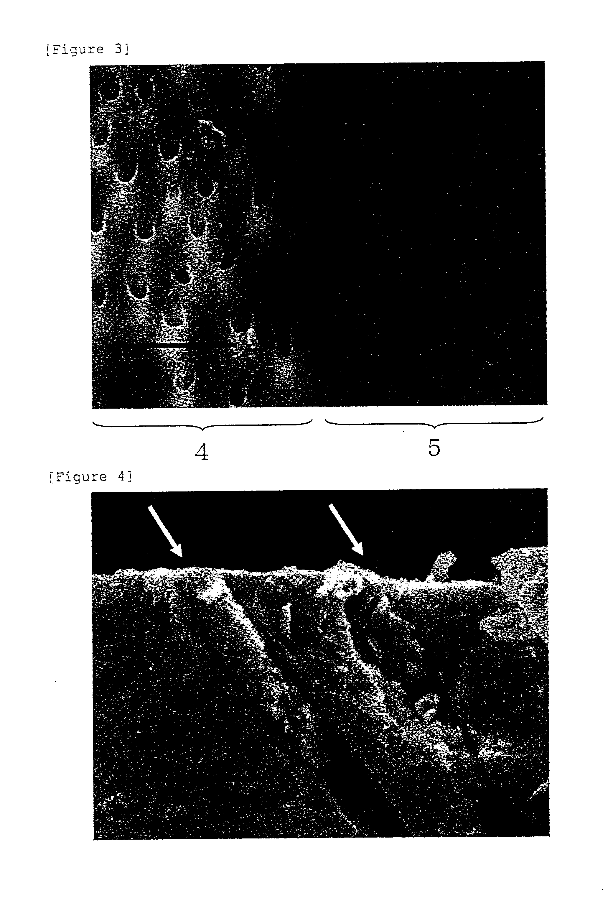 Method for inhibiting dentinal hypersensitivity