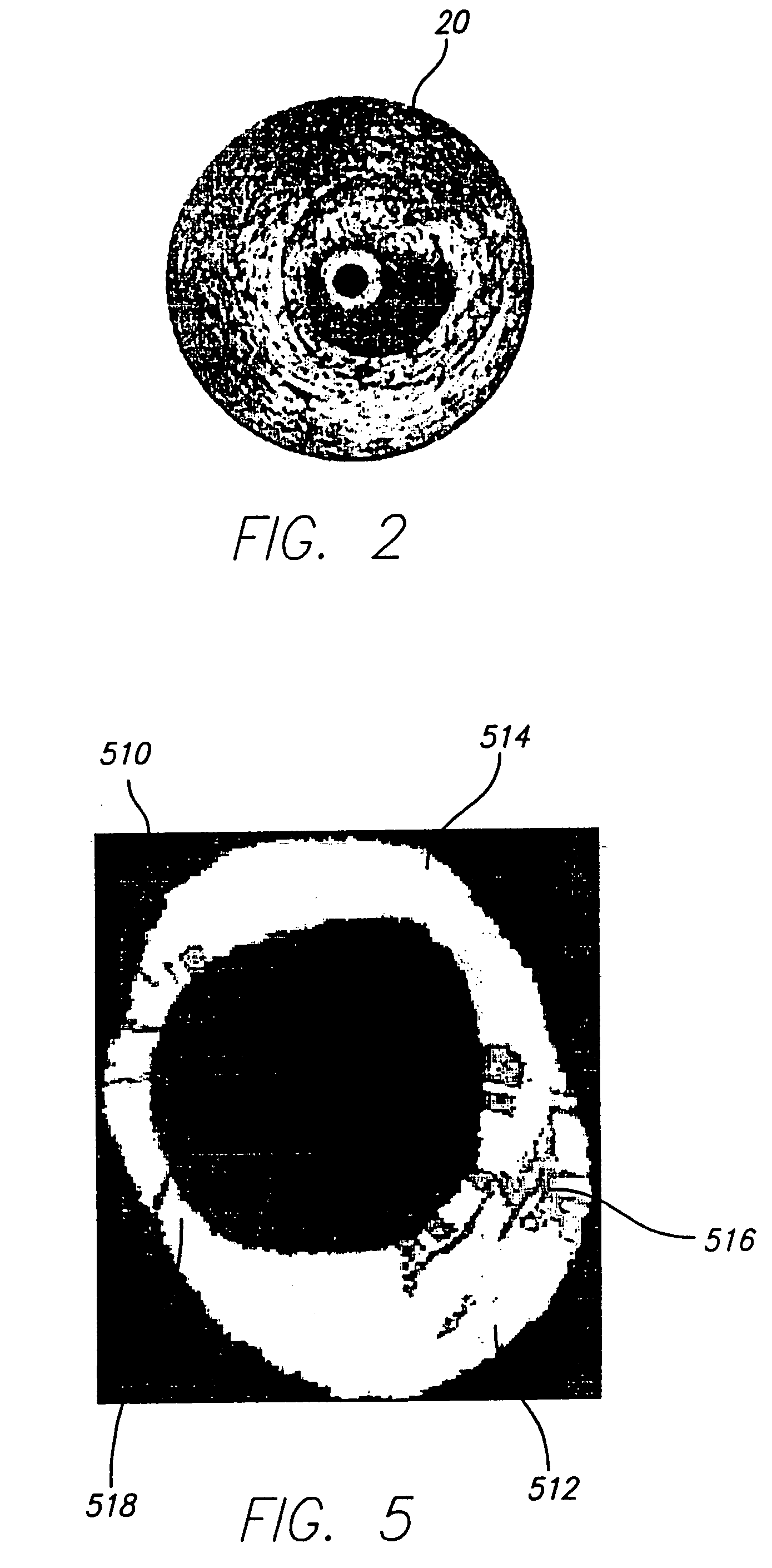 System and method of characterizing vascular tissue