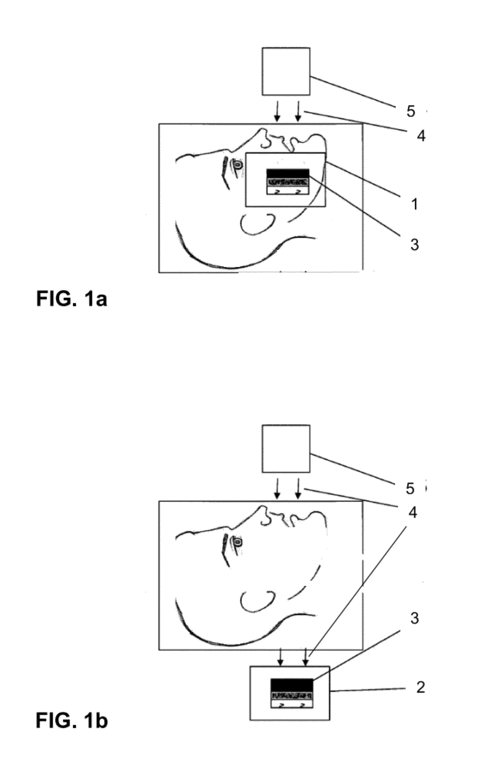 Dental fluoroscopic imaging system