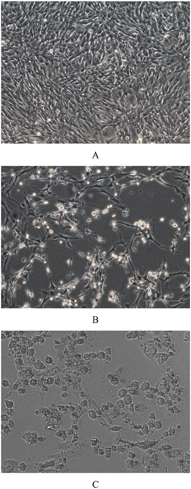 Human enterovirus strain and application thereof