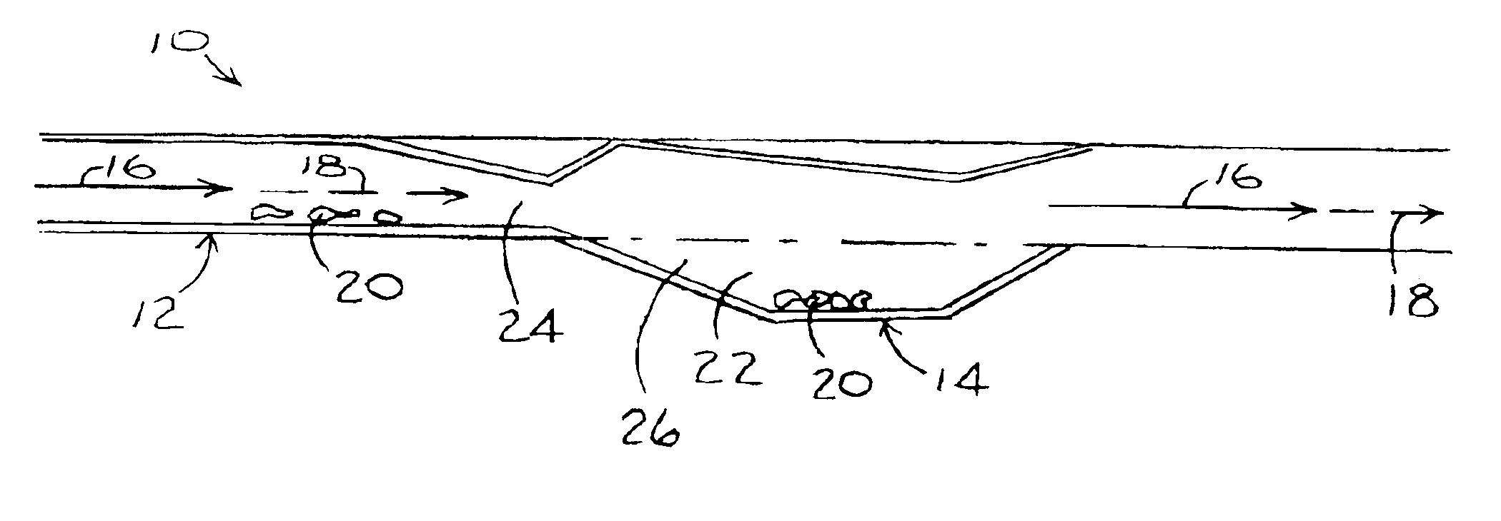 Stent assembly