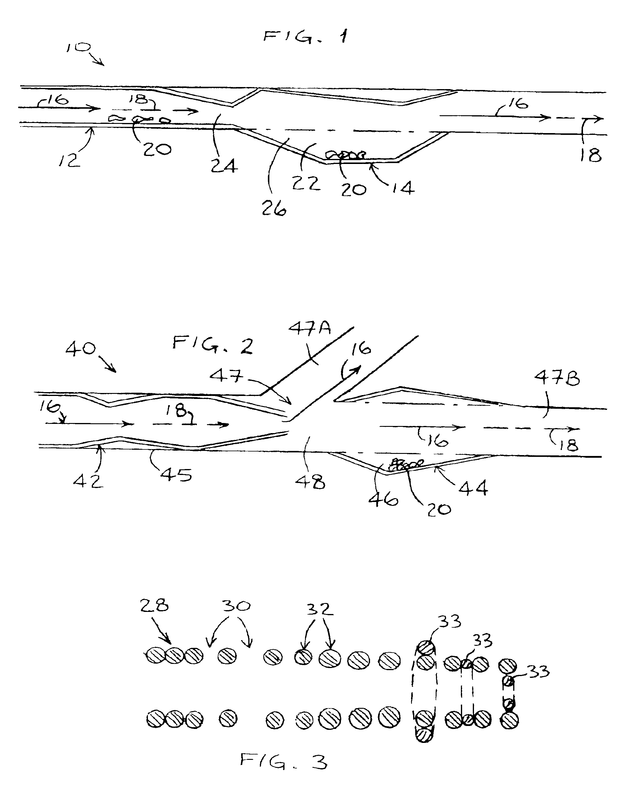 Stent assembly