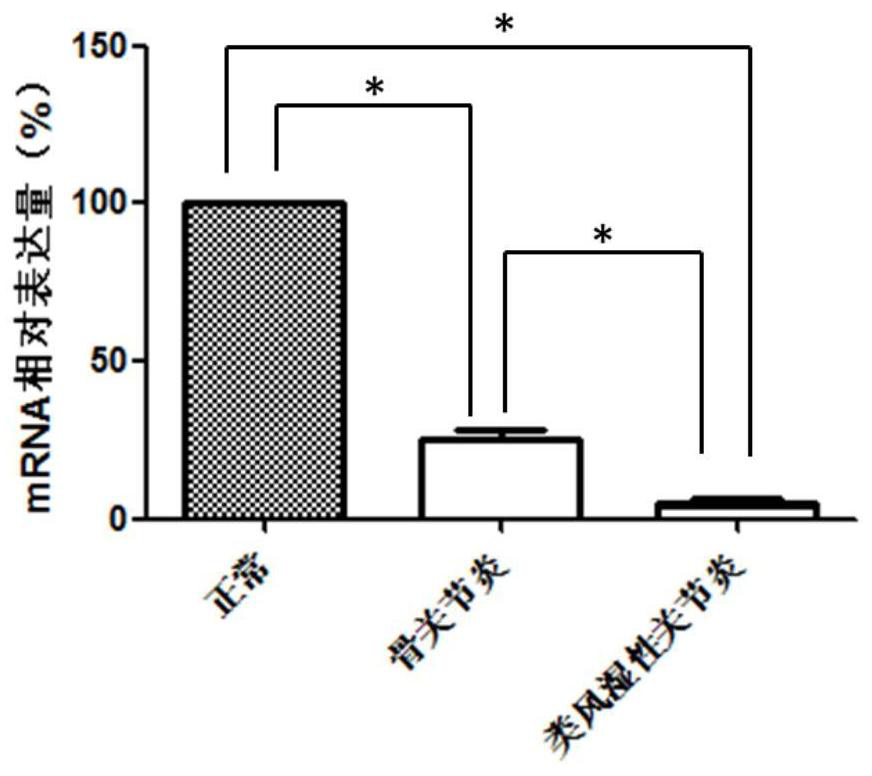 Wfs1 as a novel molecular marker