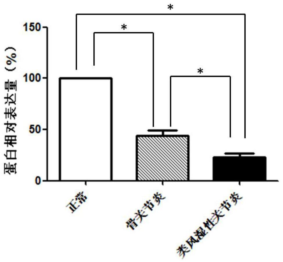 Wfs1 as a novel molecular marker