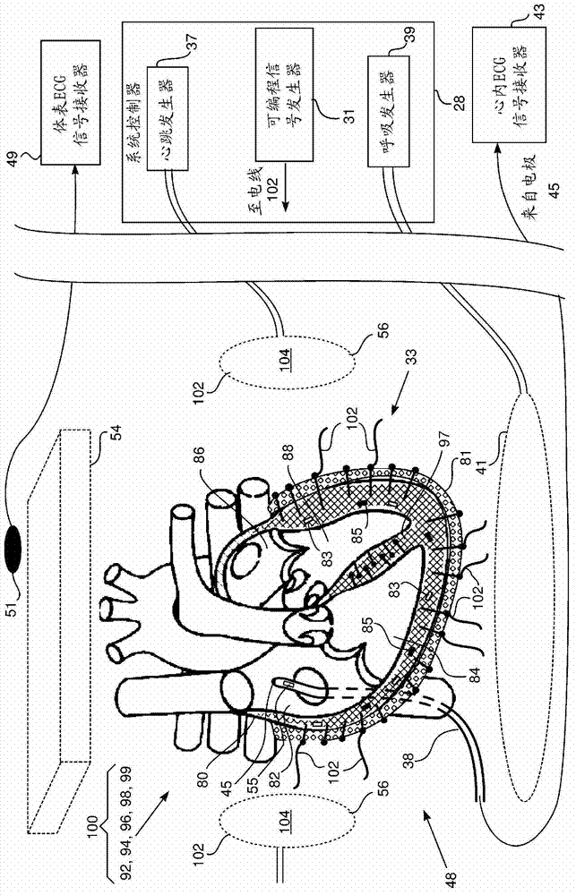 Physical heart simulator