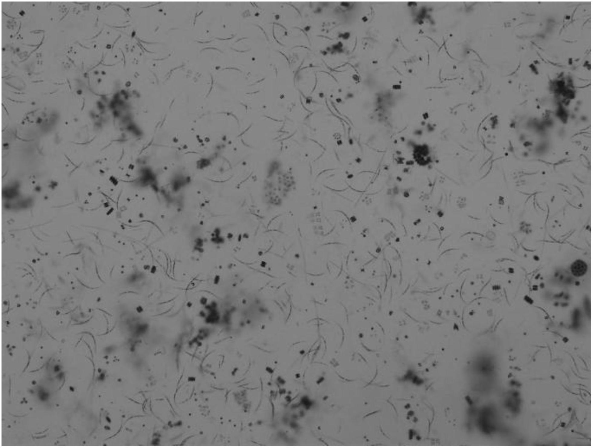 Method for culturing phytoplankton with predominant chlorophyta