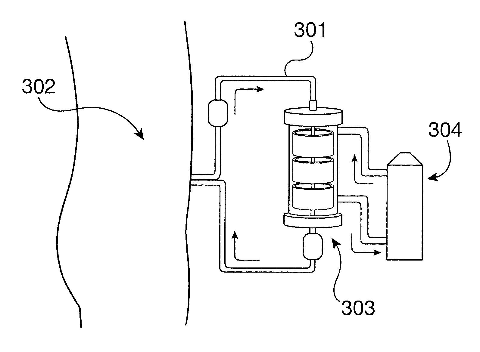 System and Method for Administering Peritoneal Dialysis