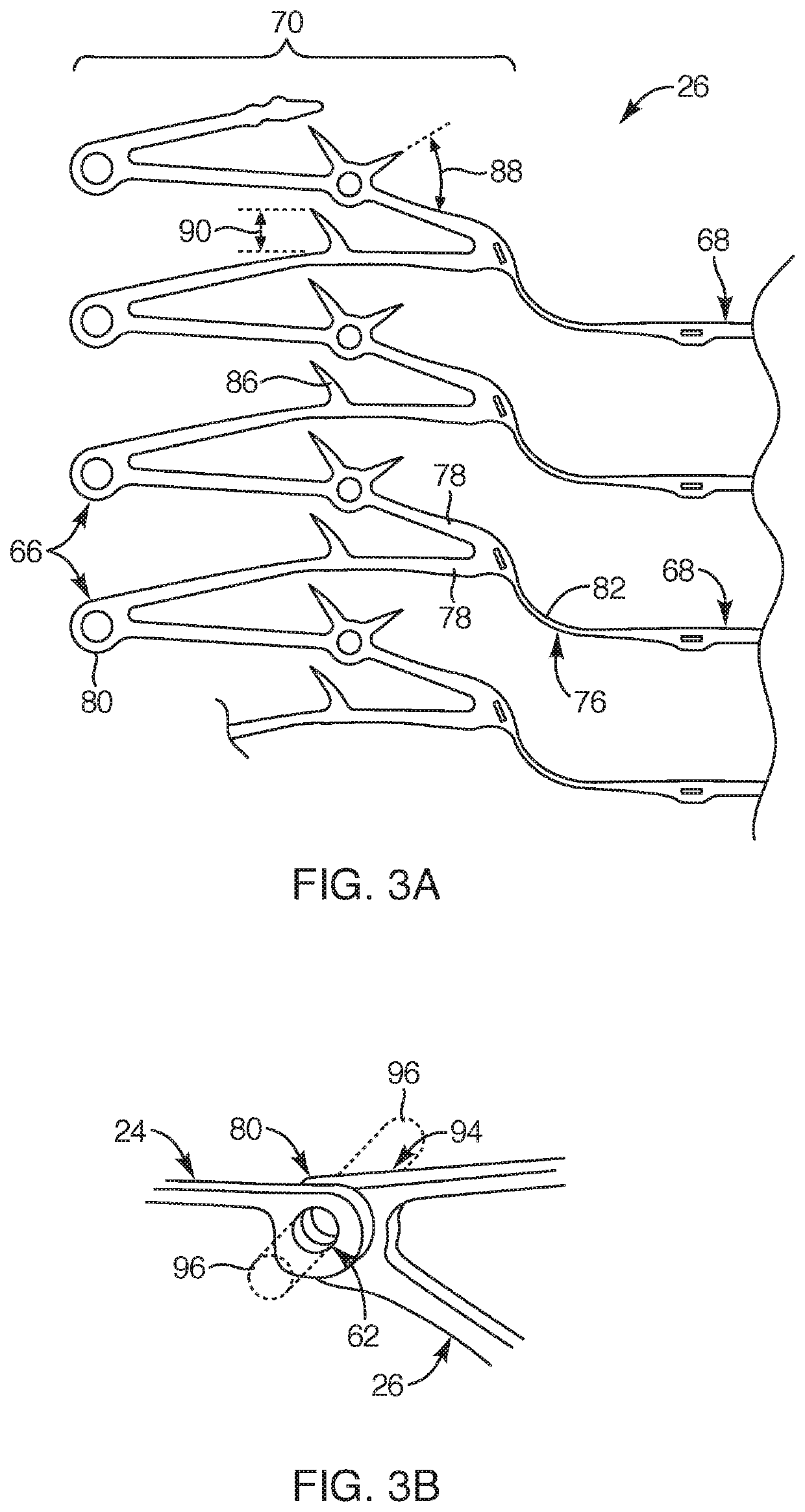 Medical device for modification of left atrial appendage and related systems and methods