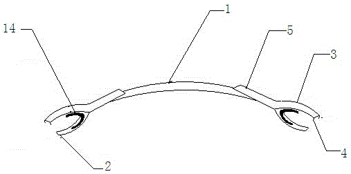 Sternum expanding device with sternal closure delaying function