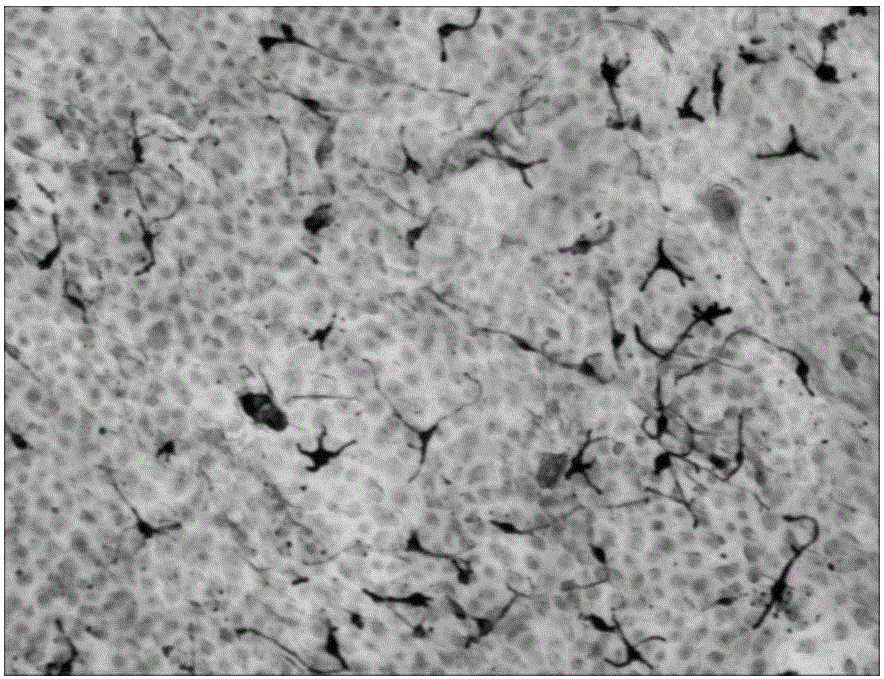 Mixed cultivation method of keratinocyte and melanocyte and application