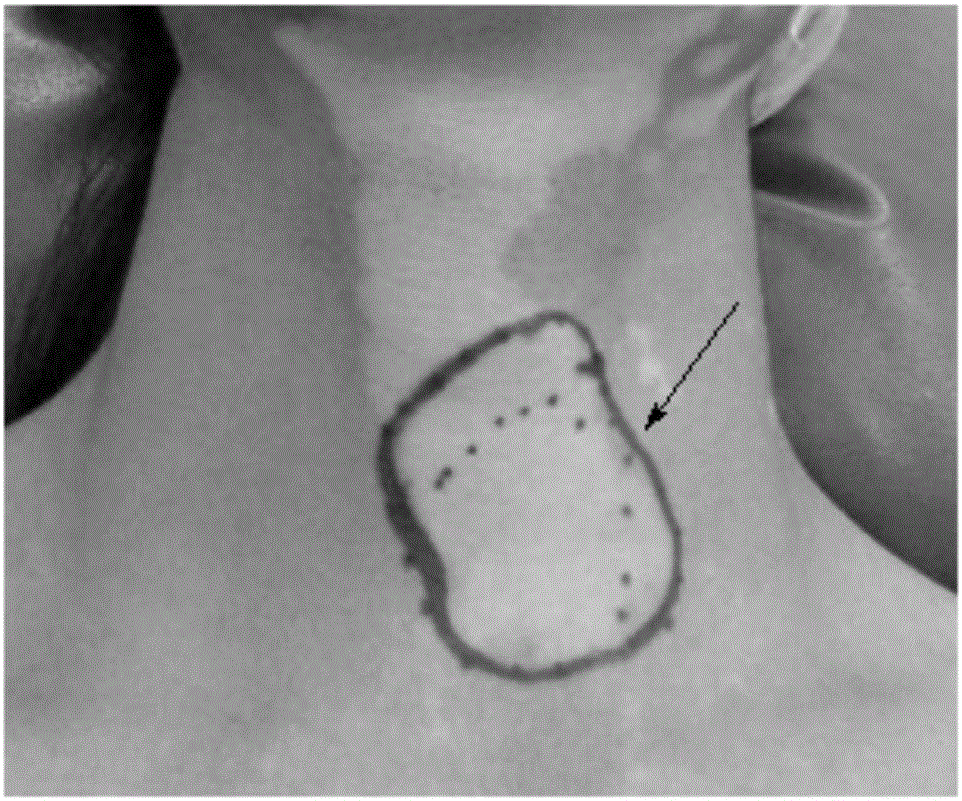 Mixed cultivation method of keratinocyte and melanocyte and application