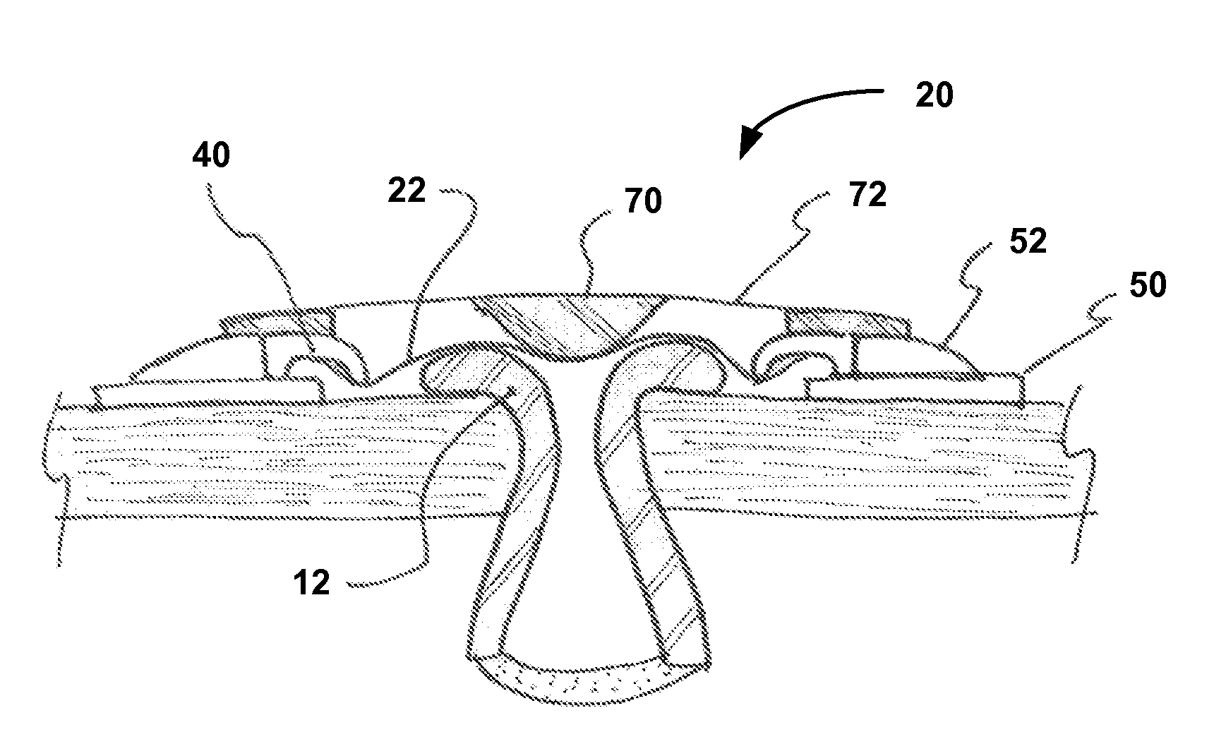 Seal for controlled evacuation ostomy appliance