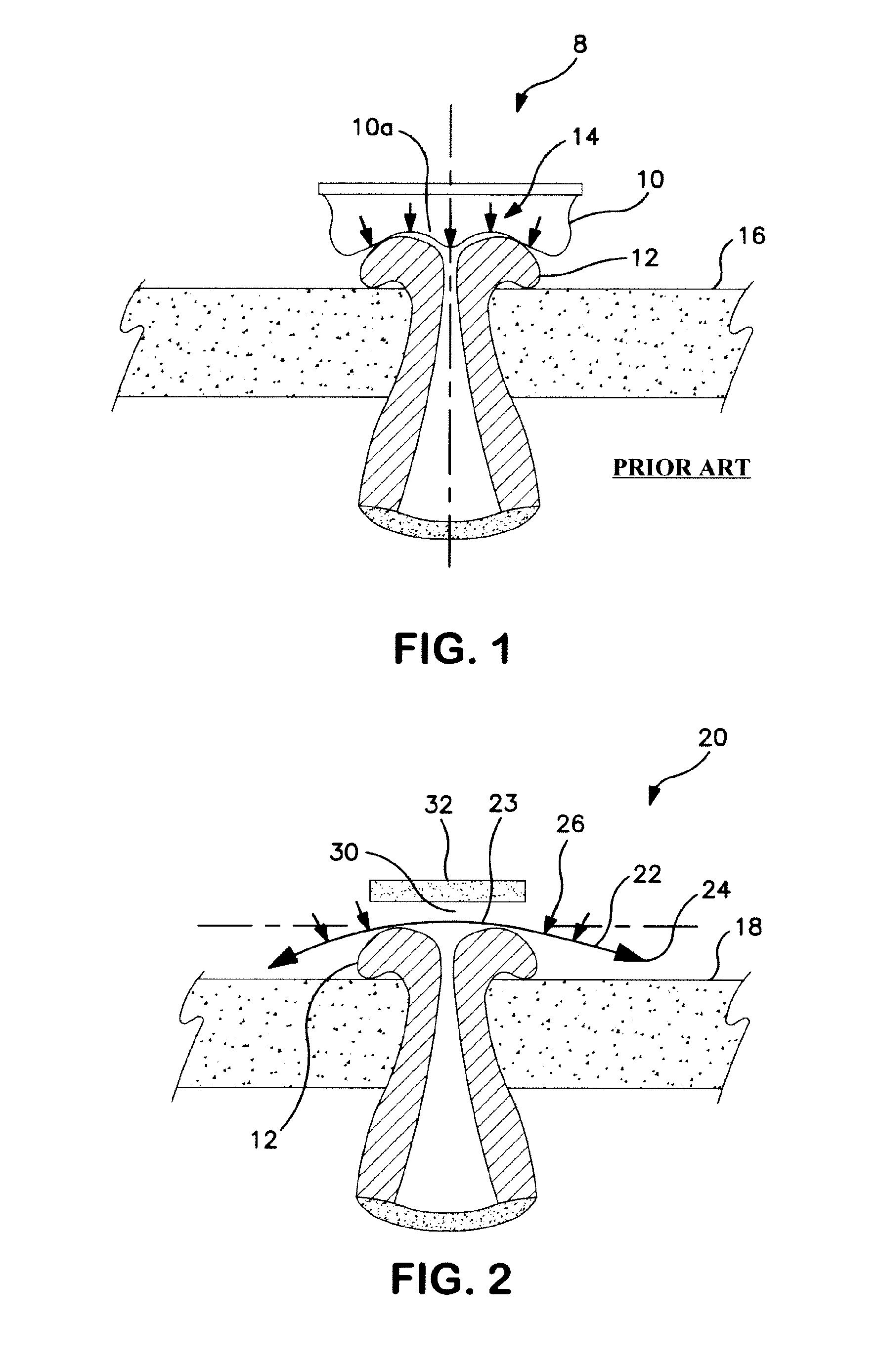 Seal for controlled evacuation ostomy appliance