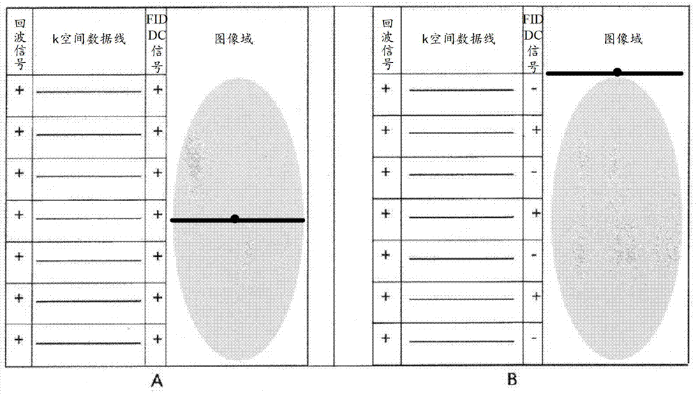 Method and device for magnetic resonance image acquisition and reconstruction