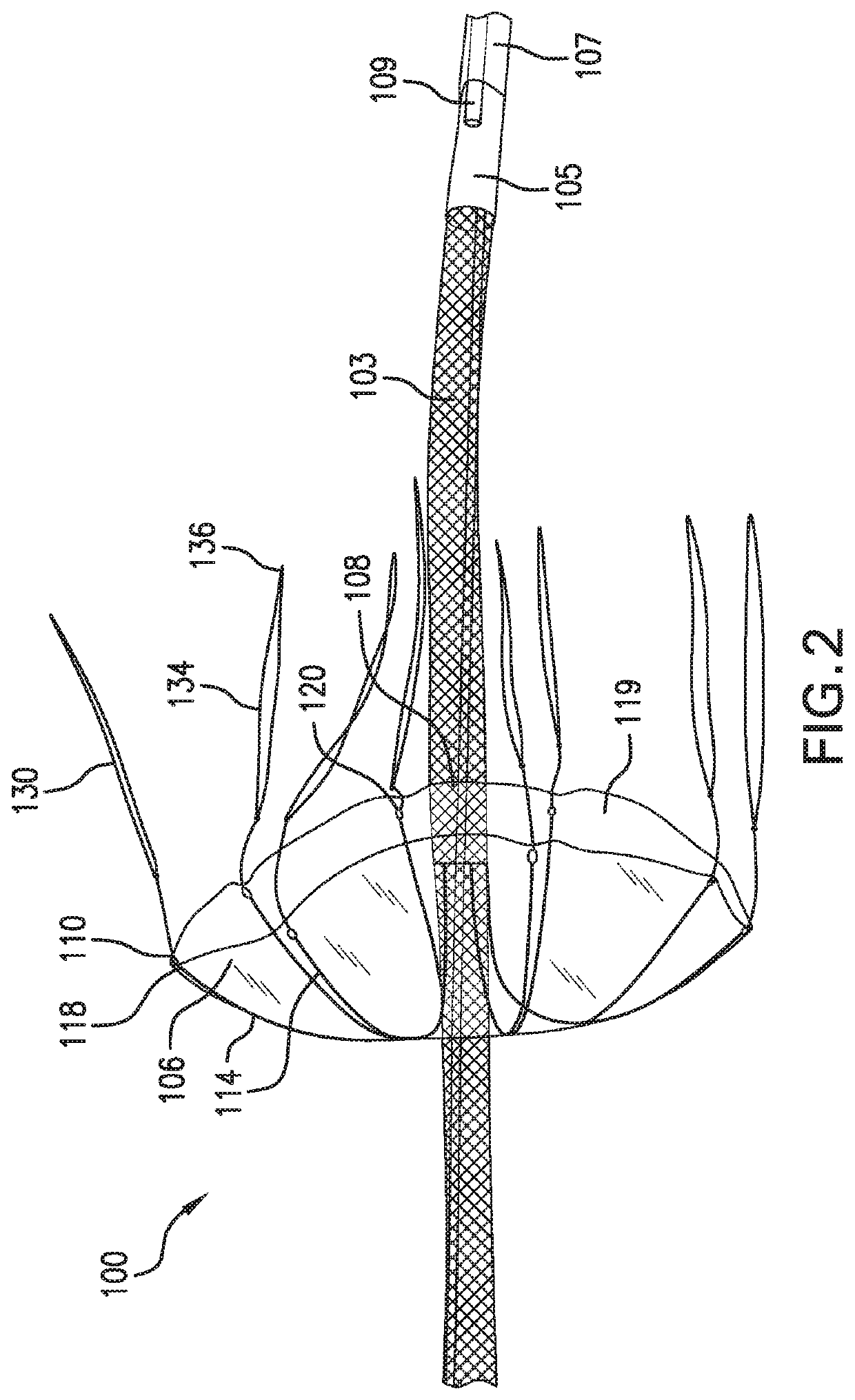 Inverting temporary valve sheath