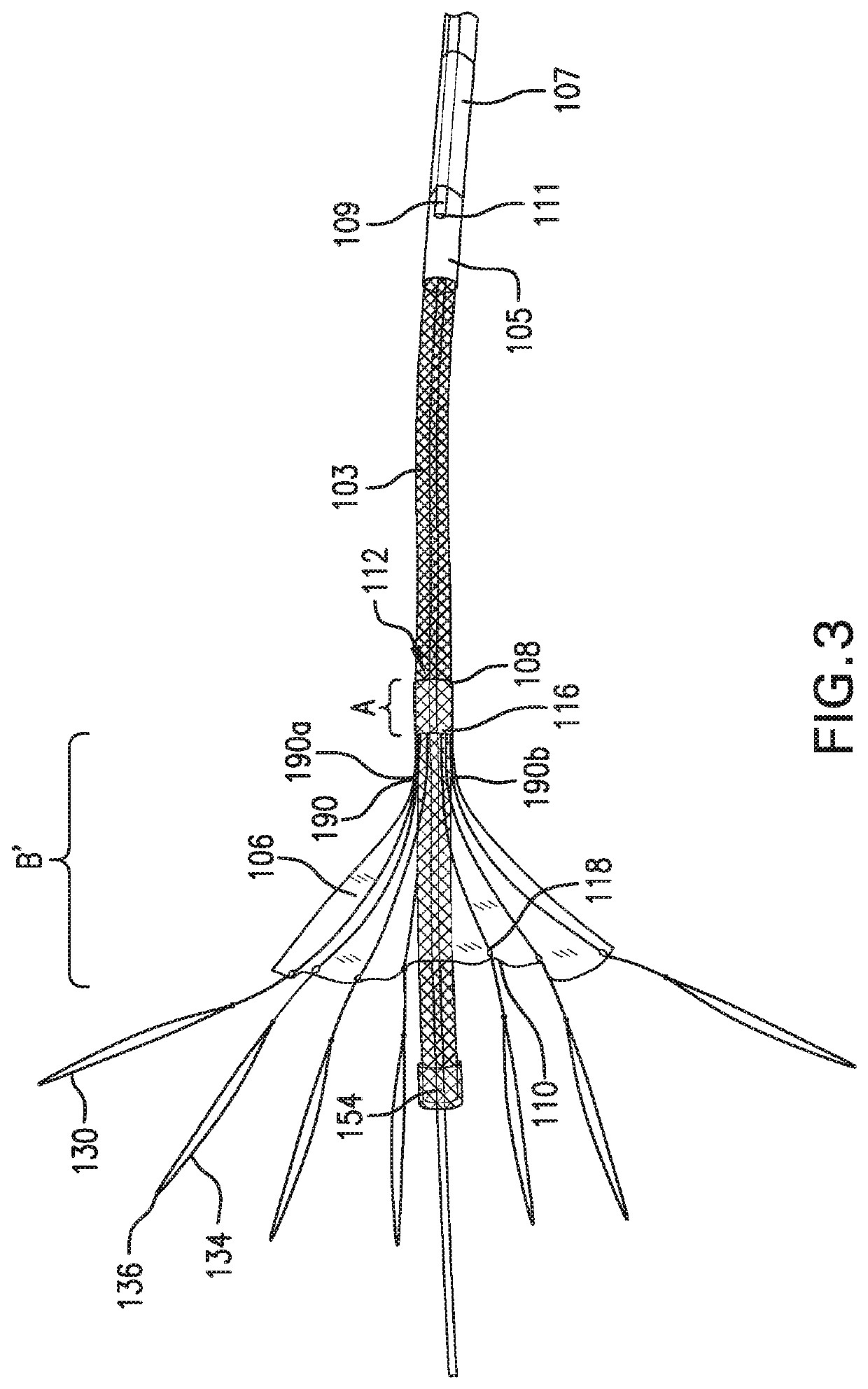 Inverting temporary valve sheath