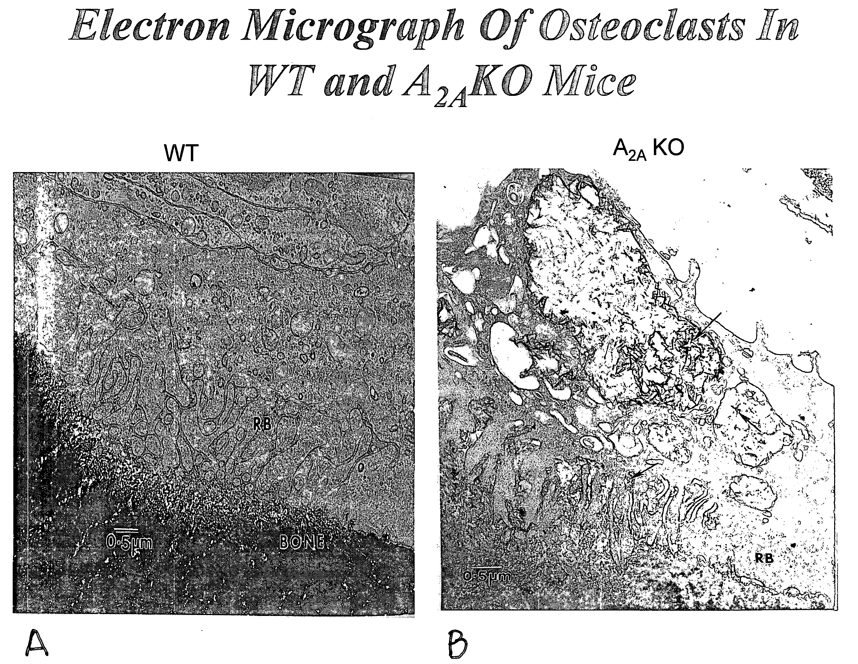 Medical implants containing adenosine receptor agonists and methods for inhibiting medical implant loosening