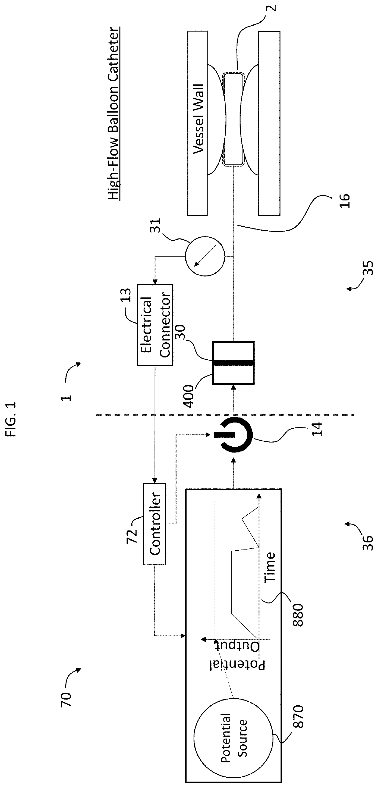 Pulsatile Balloon Catheter Systems and Methods of Using the Same