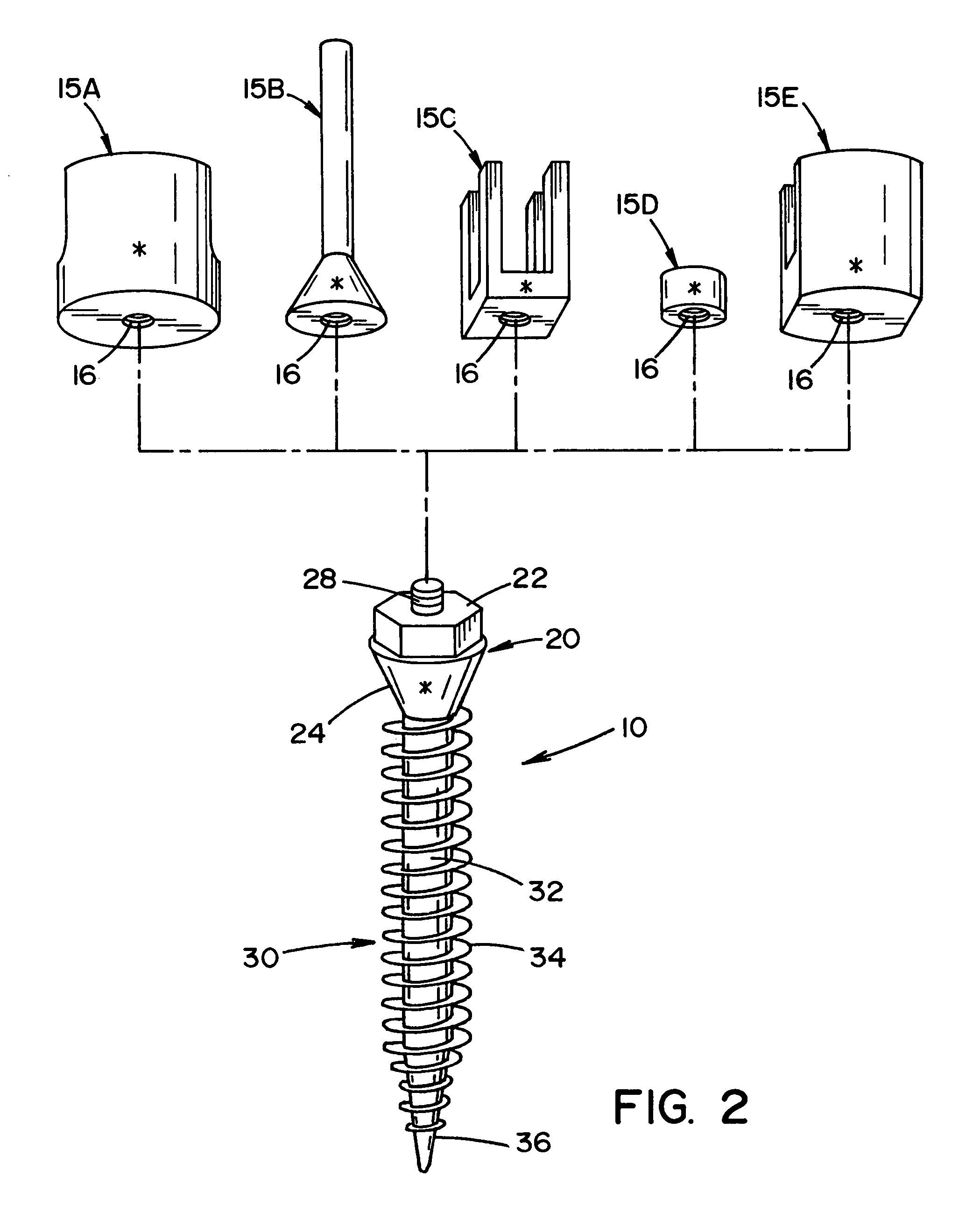 Bone anchor prosthesis and system