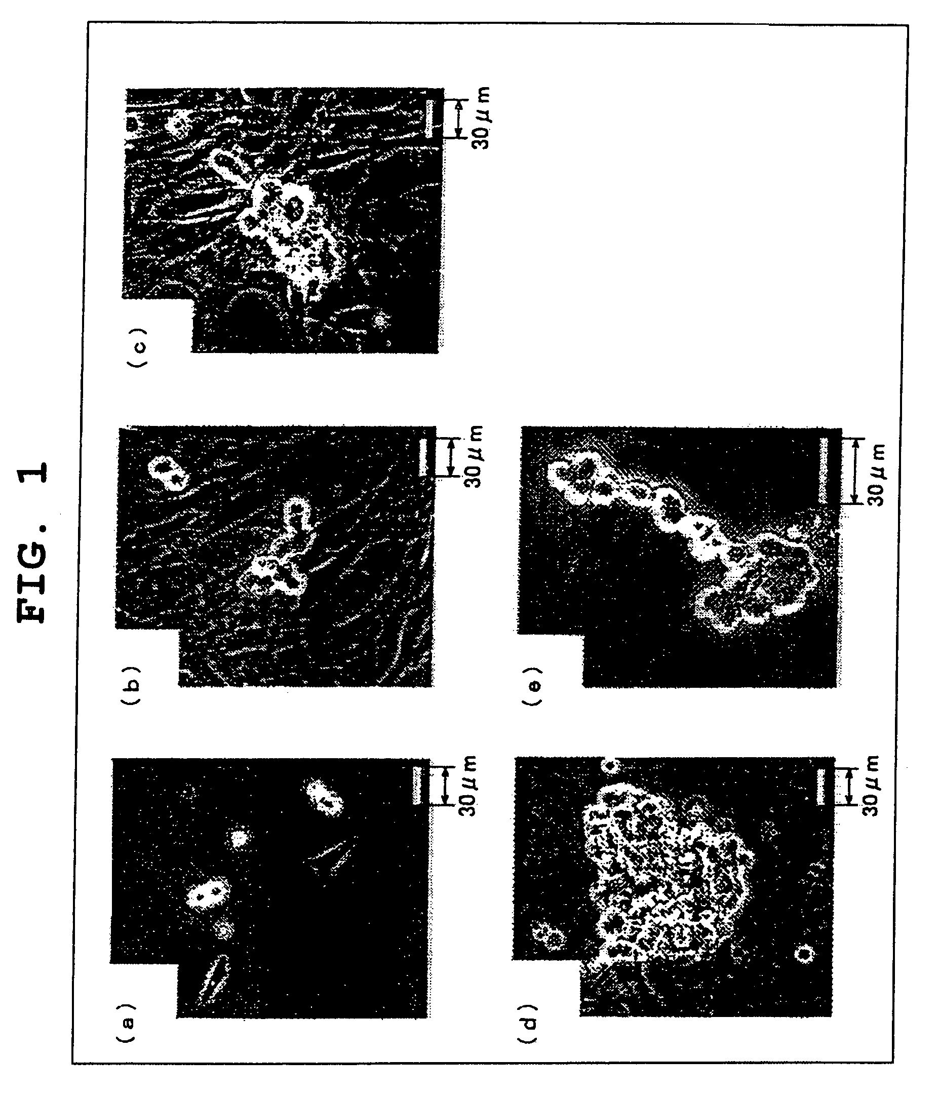 Method of growing sperm stem cells in vitro, sperm stem cells grown by the method, and medium additive kit to be used in growing sperm stem cells in vitro