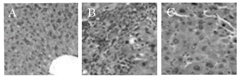 Stem cell preparation for treating hepatic fibrosis