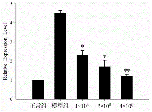 Stem cell preparation for treating hepatic fibrosis