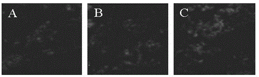 Stem cell preparation for treating hepatic fibrosis