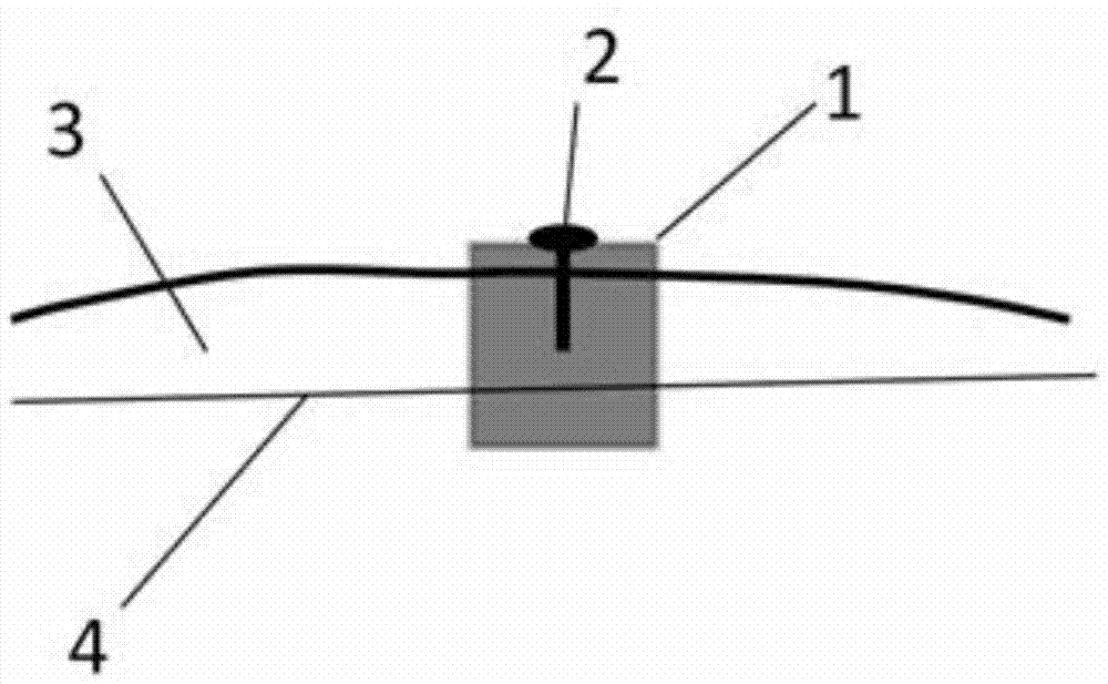 Method for monitoring erosion amount and erosion rate of bank slope