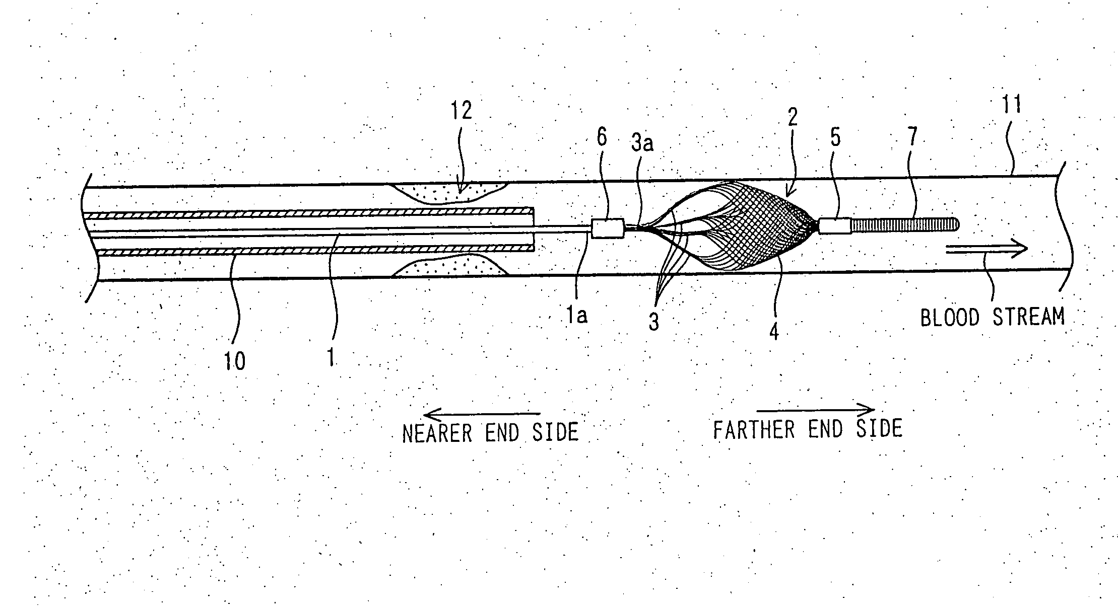 Wire for inserting into biological duct