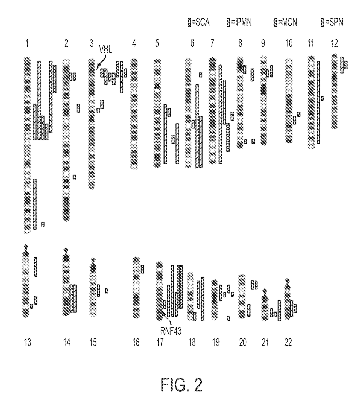 Differential identification of pancreatic cysts