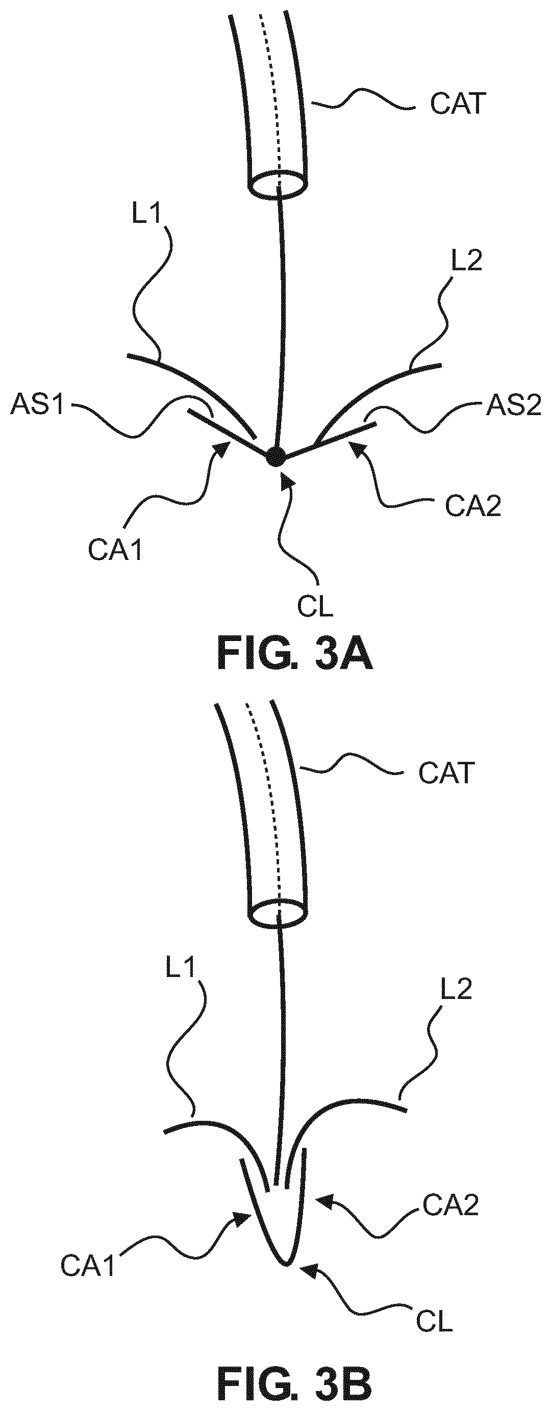 Signal-triggered interventional device control