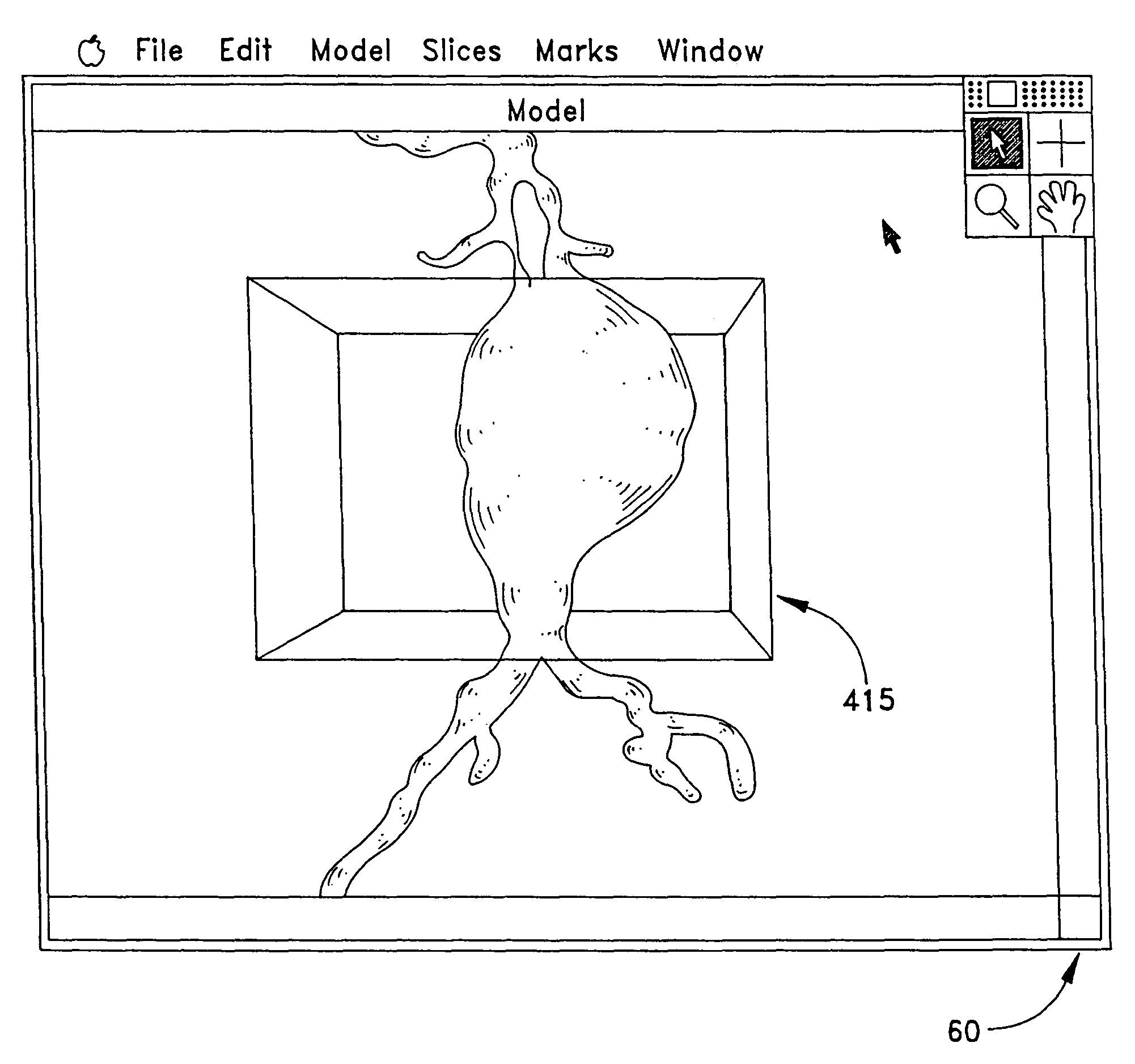 Method for determining the risk of rupture of a blood vessel