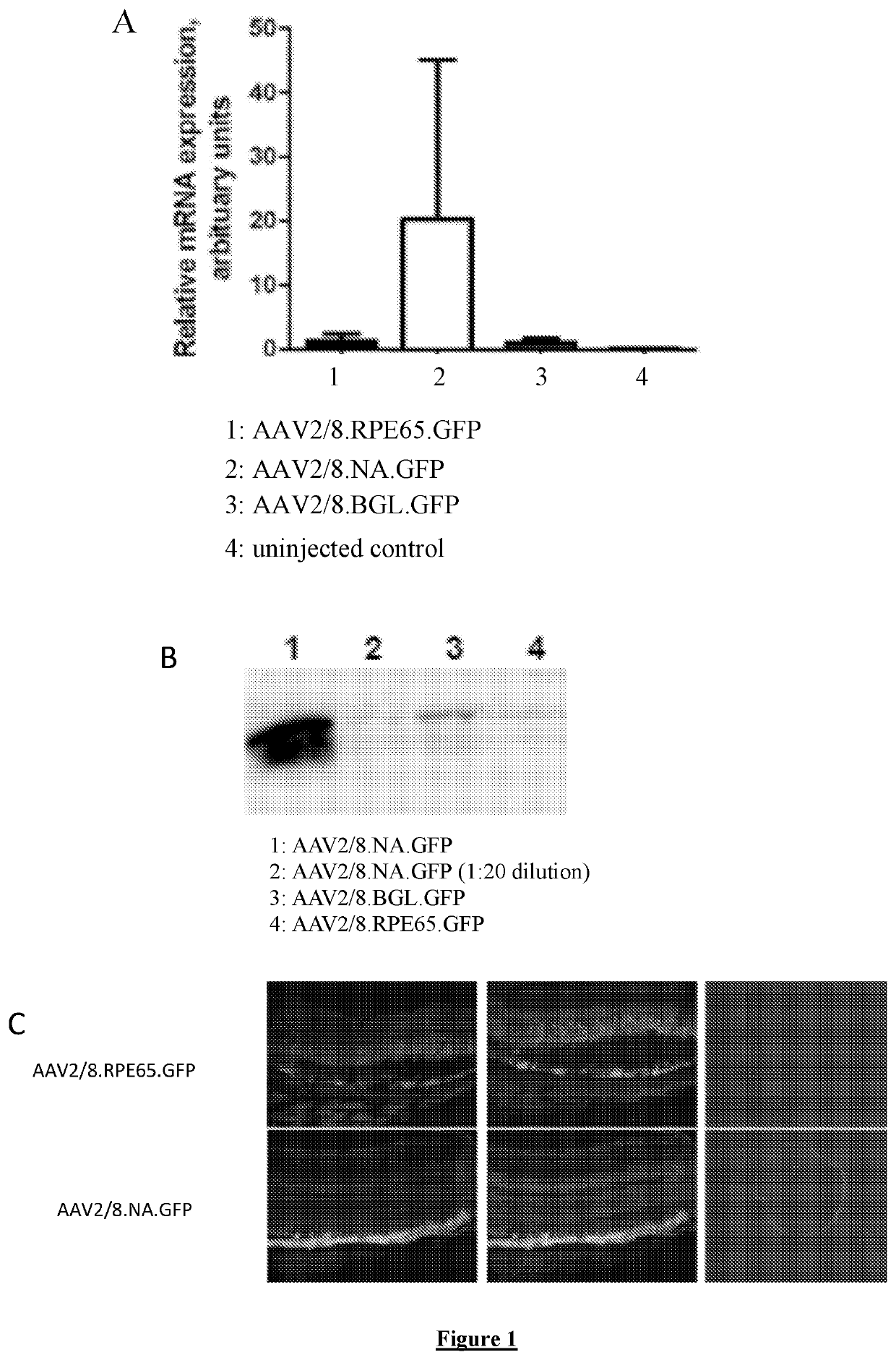 Optimized RPE65 promoter and coding sequences