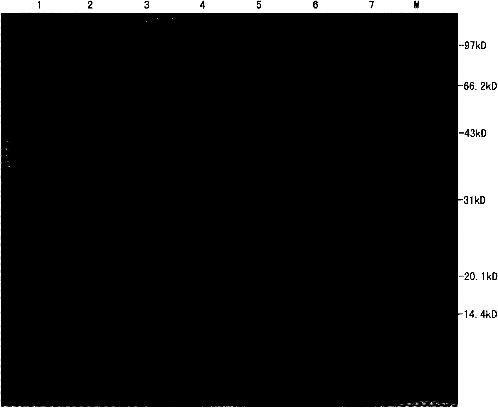 Method for efficient expression, renaturation and purification of lipocalin