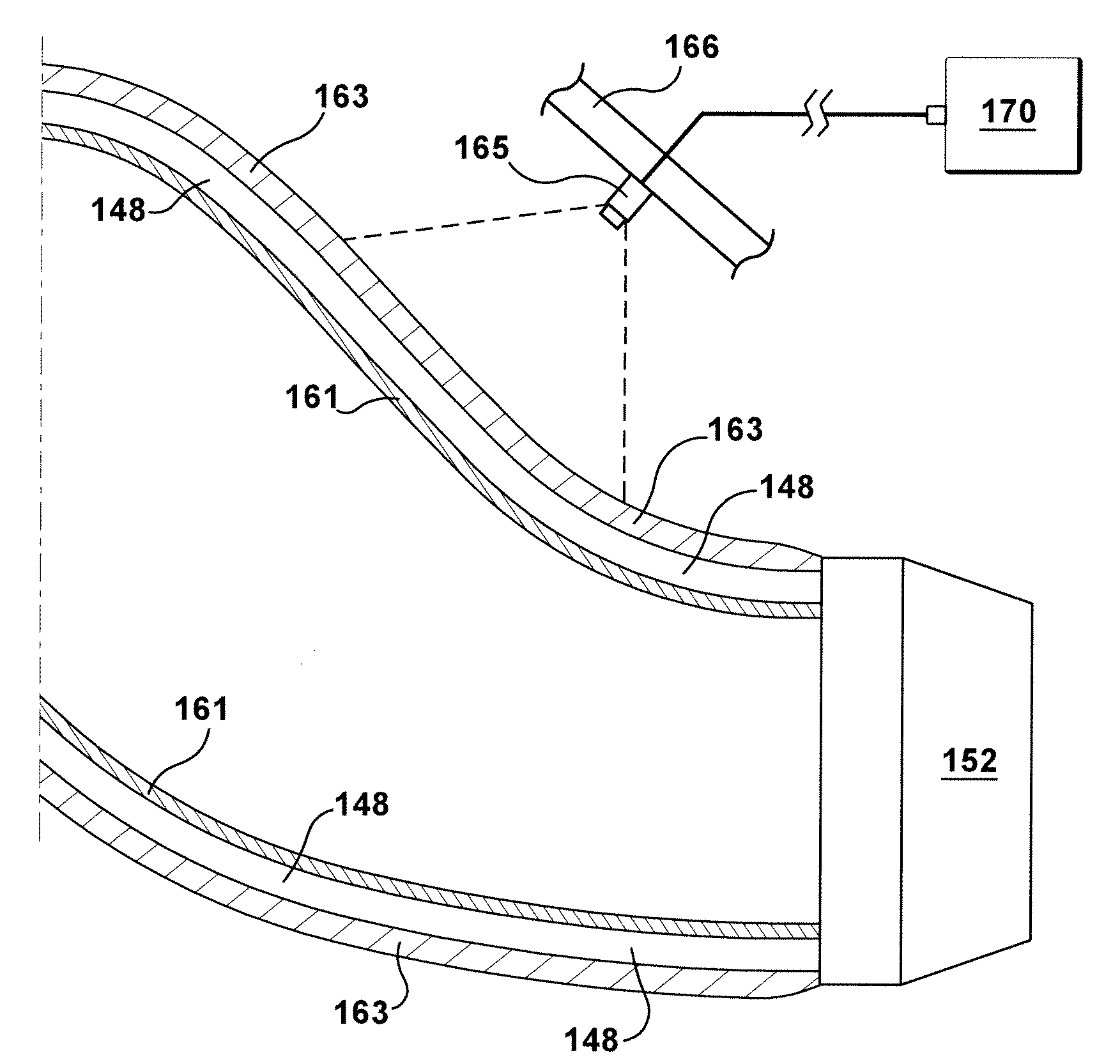 Methods, systems and apparatus for detecting material defects in combustors of combustion turbine engines