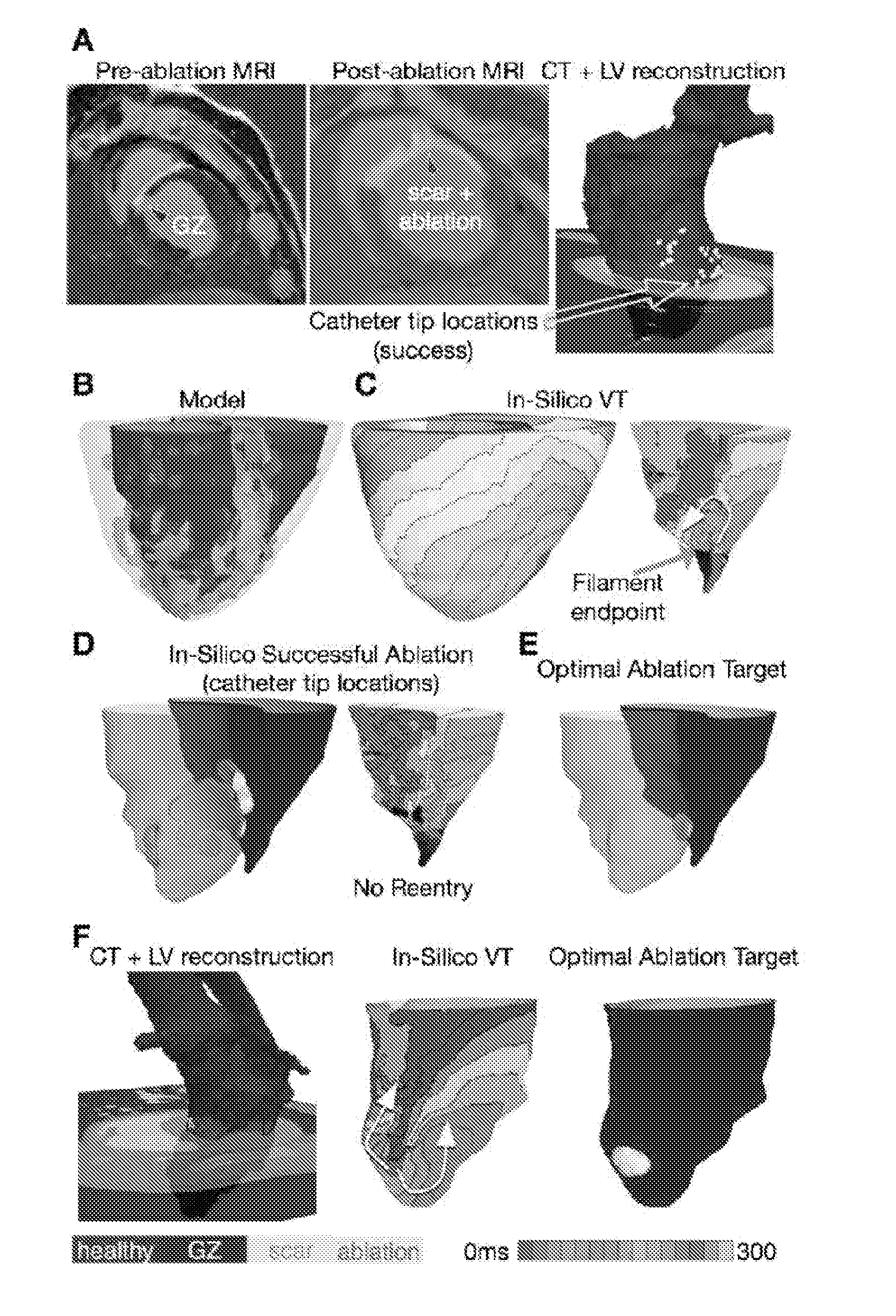 System and method for planning a patient-specific cardiac procedure