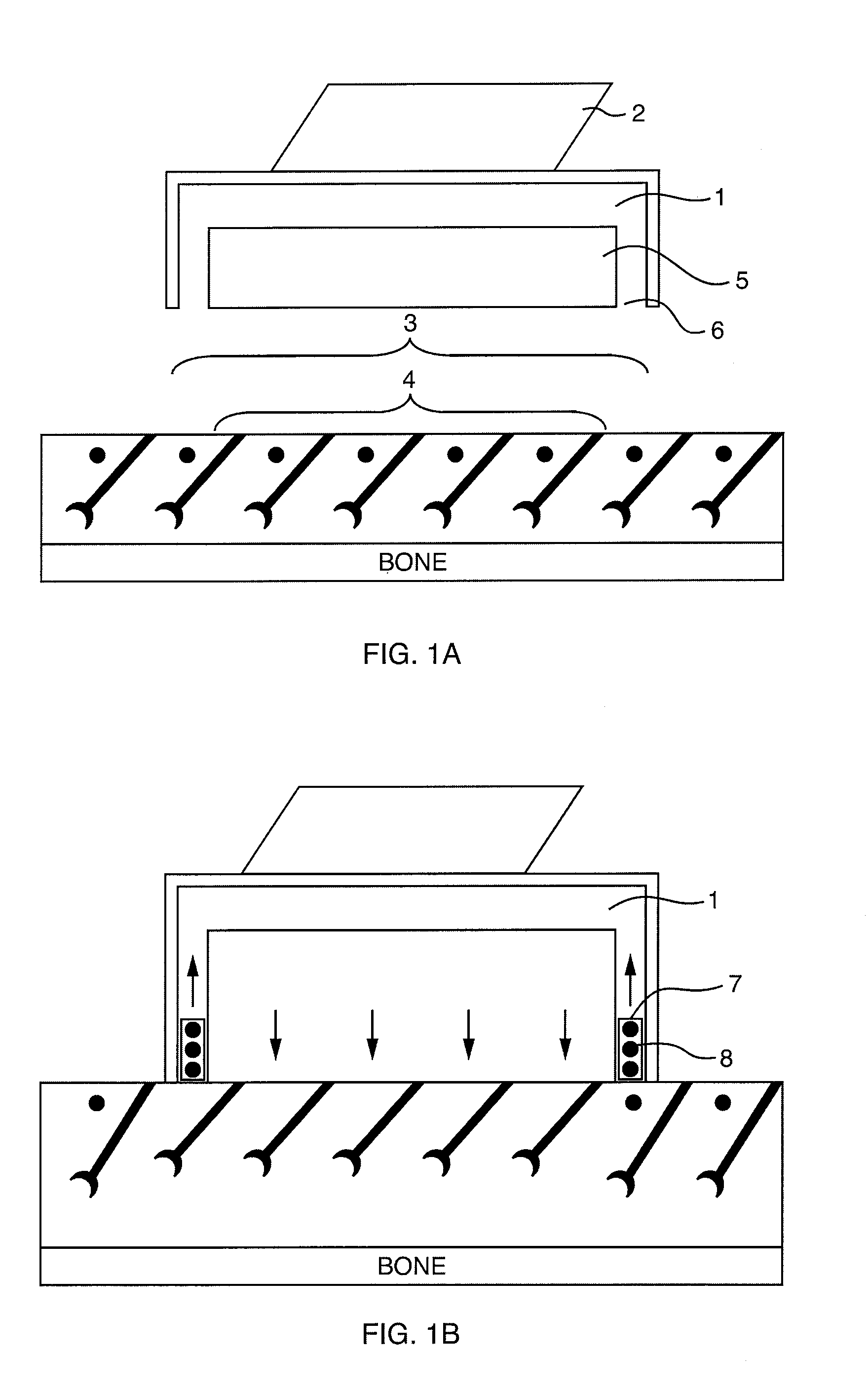 Apparatus and method for skin treatment with compression and decompression