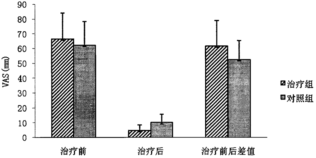 Clinical study method of Jiaji point injection vidarabine monphosphate