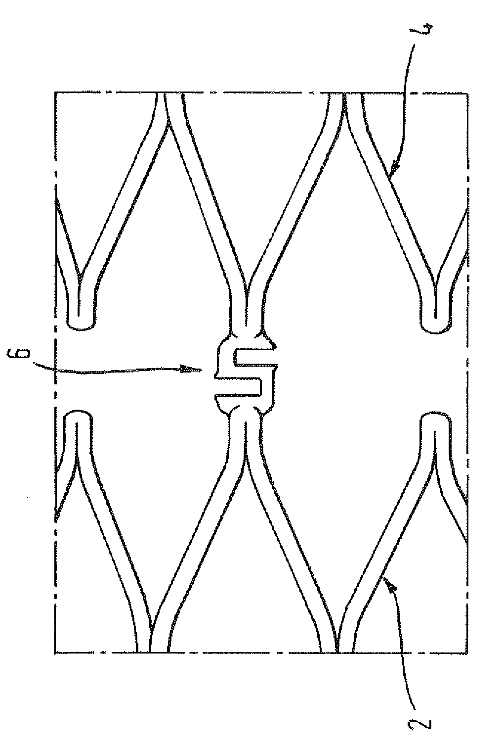 Stent