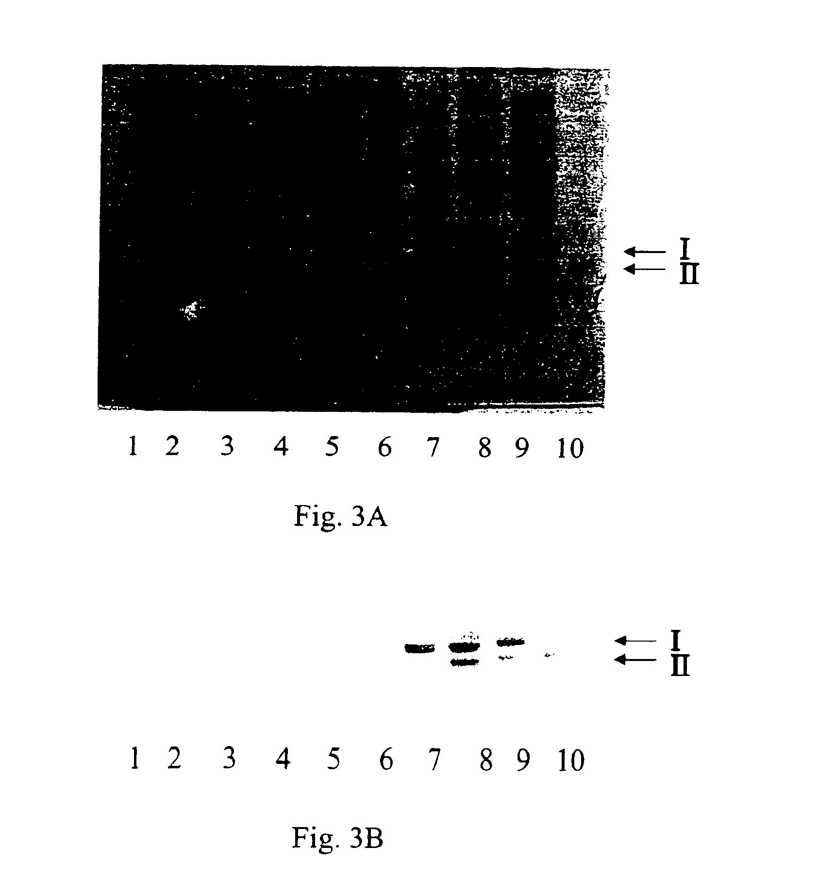 Microbial protein expression system