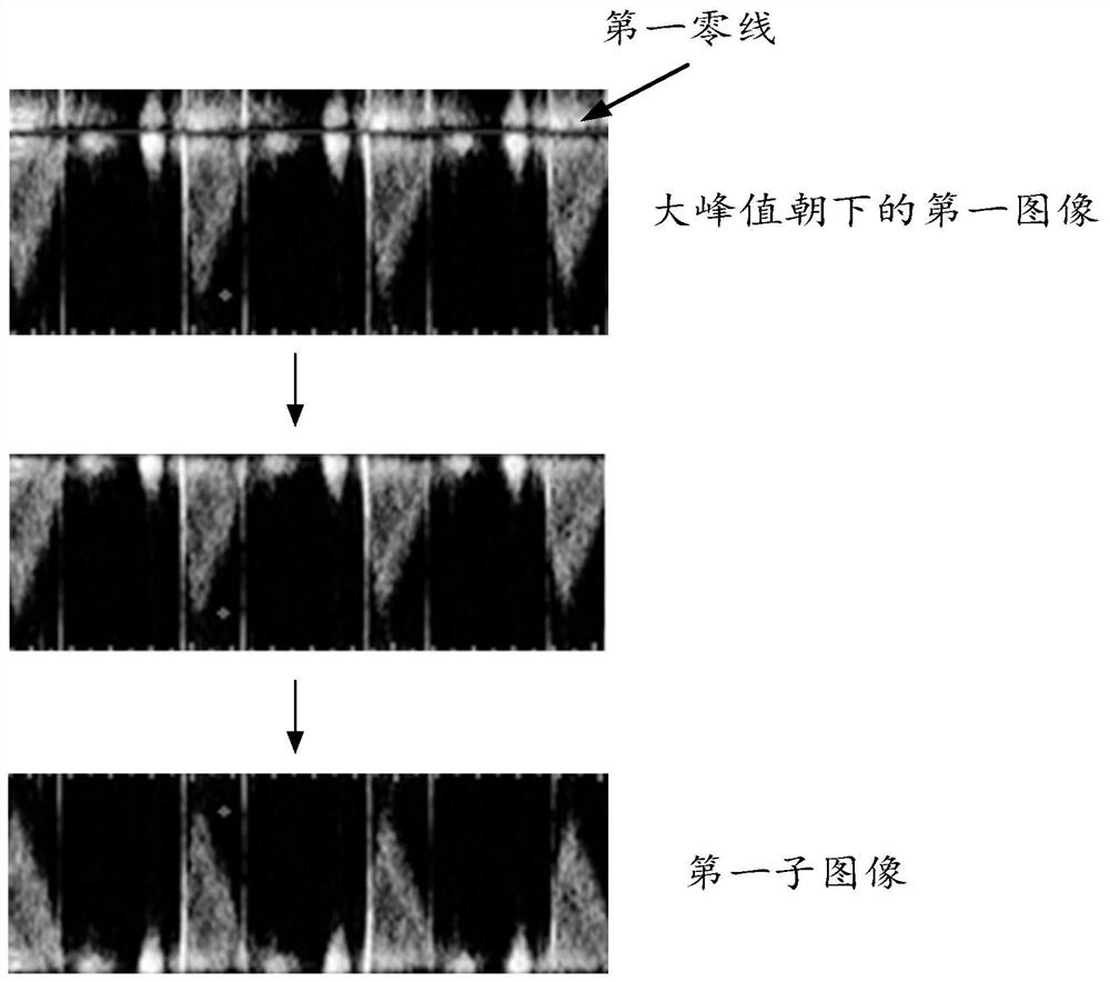 Method and device for processing two-dimensional spectrum Doppler echocardiography image