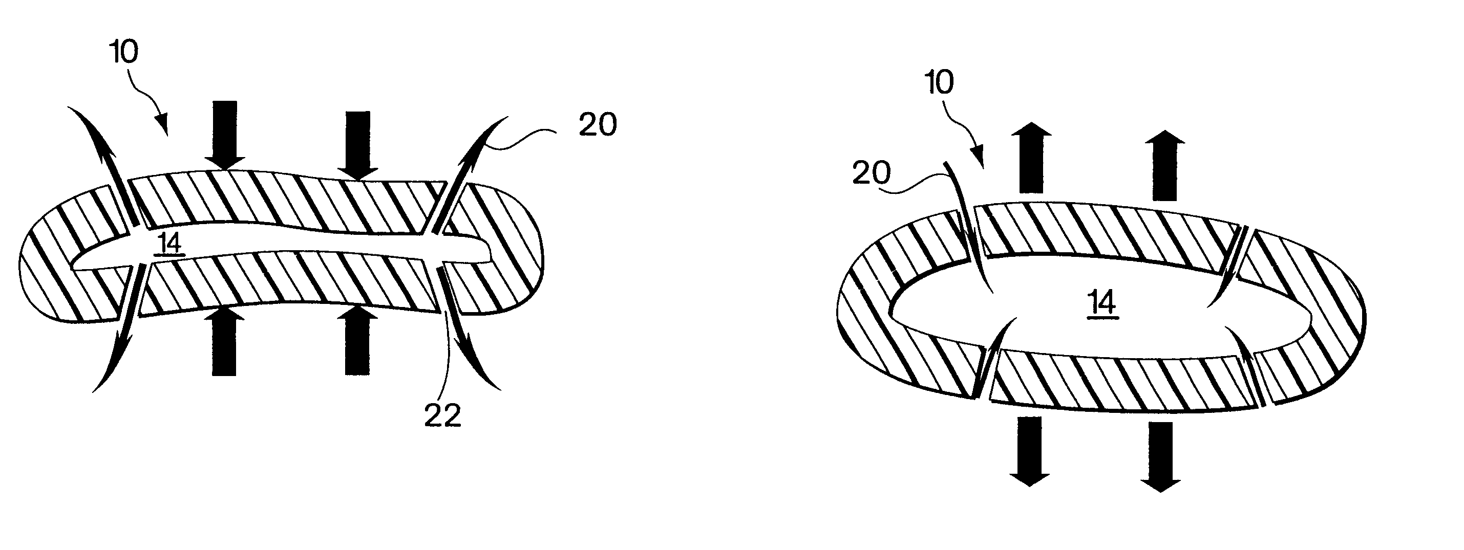 Flexible vascular inducing implants and methods