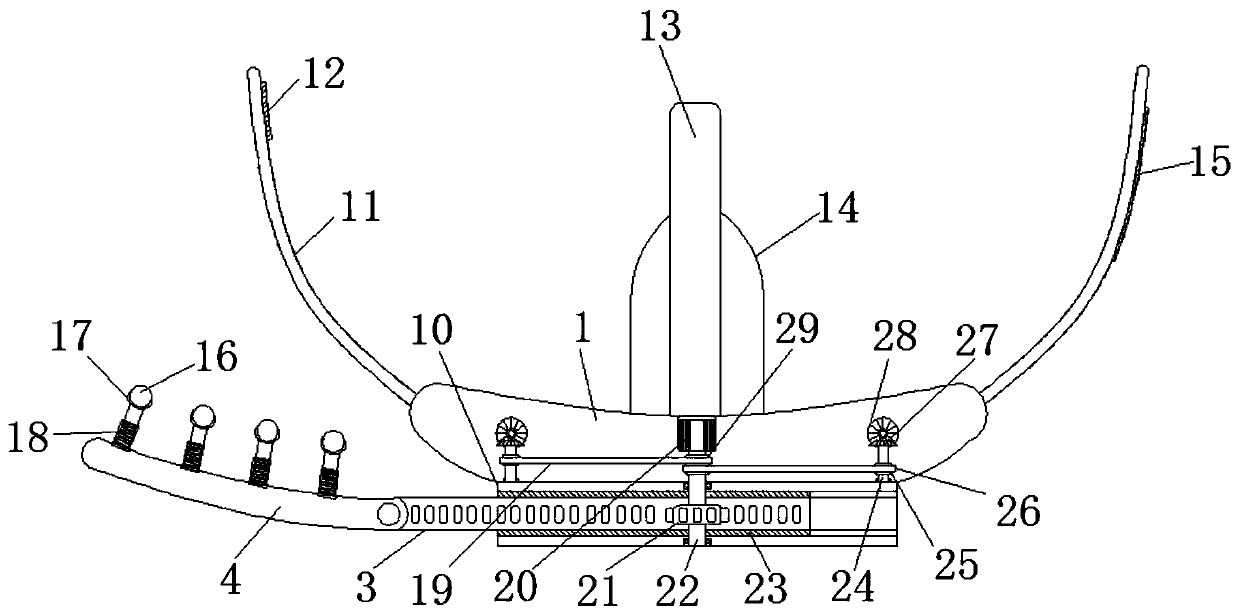 Novel pharyngeal ventilation device for anesthesiology department