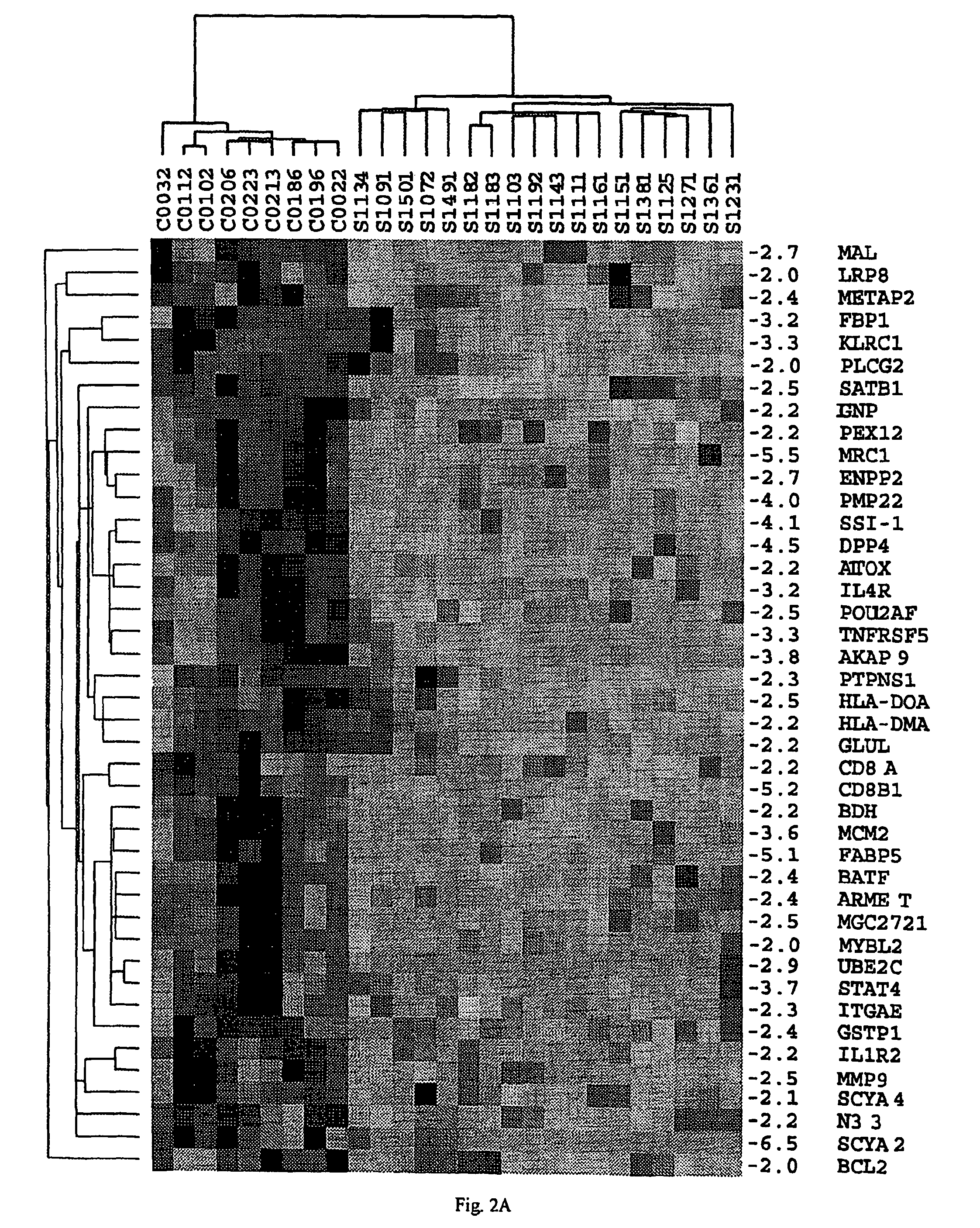 Method of diagnosis of cancer based on gene expression profiles in cells