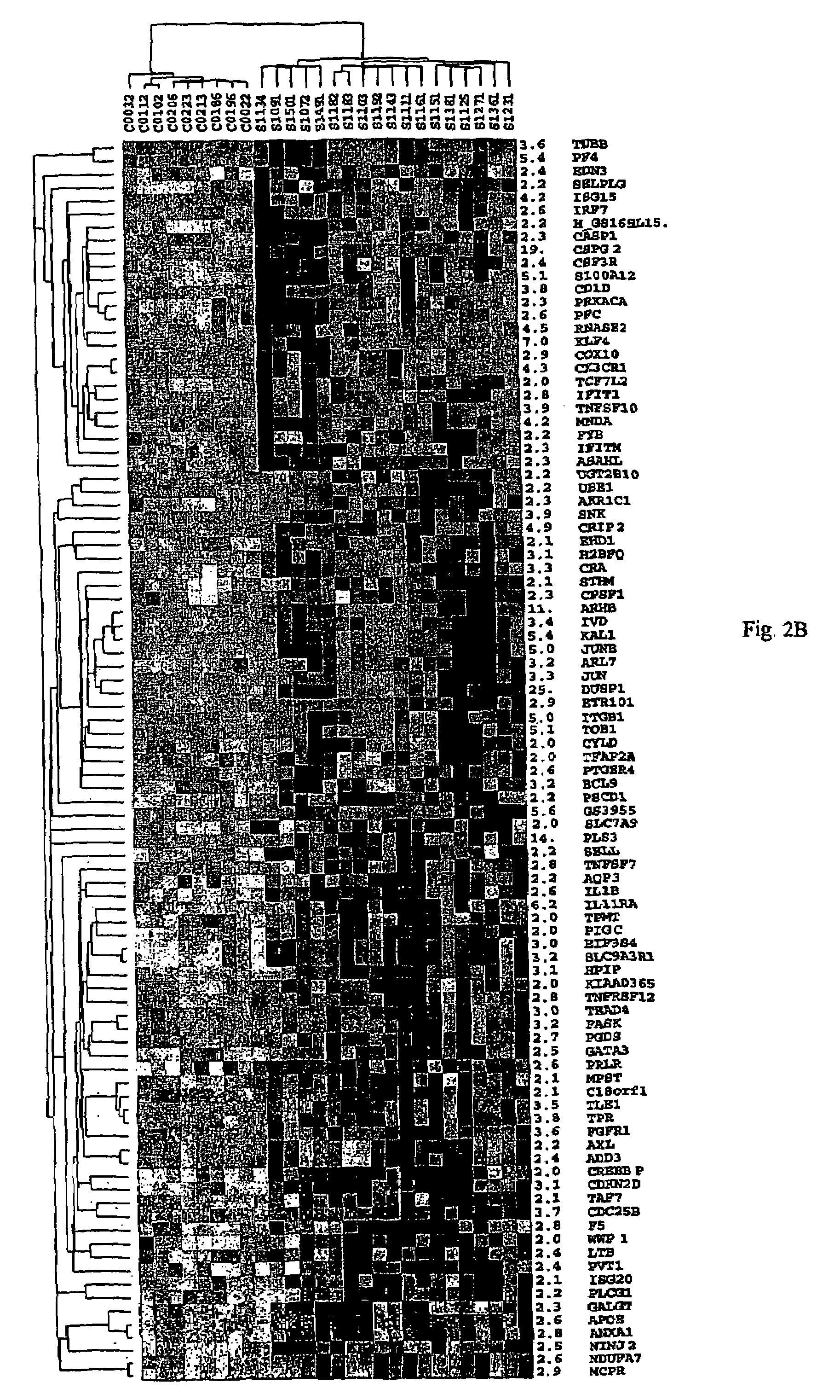 Method of diagnosis of cancer based on gene expression profiles in cells