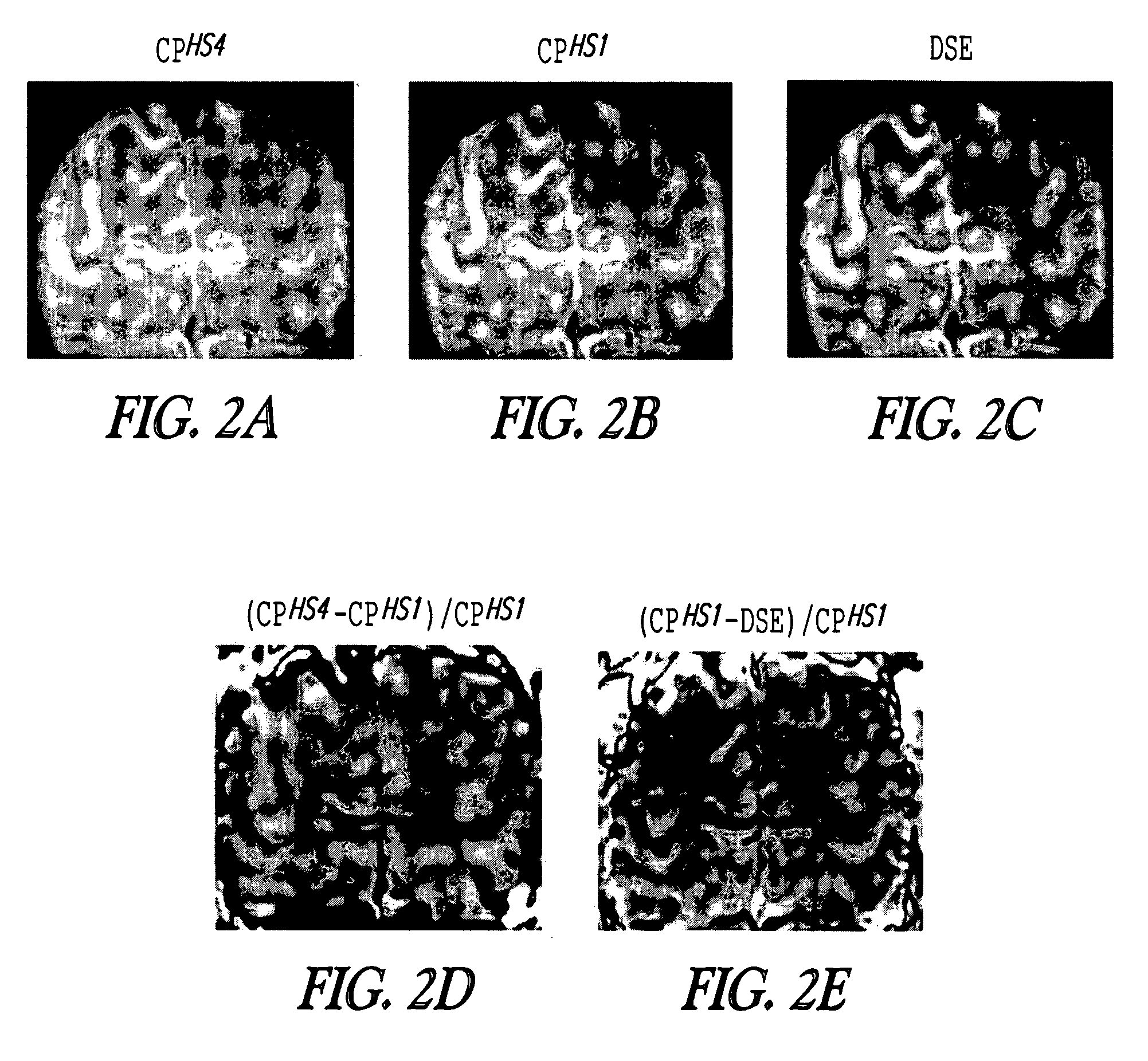 Contrast from rotating frame relaxation by adiabatic pulses