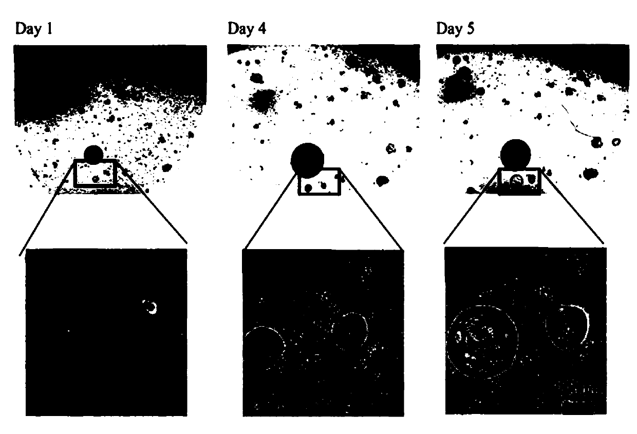 In vitro culture method of cancer type organs