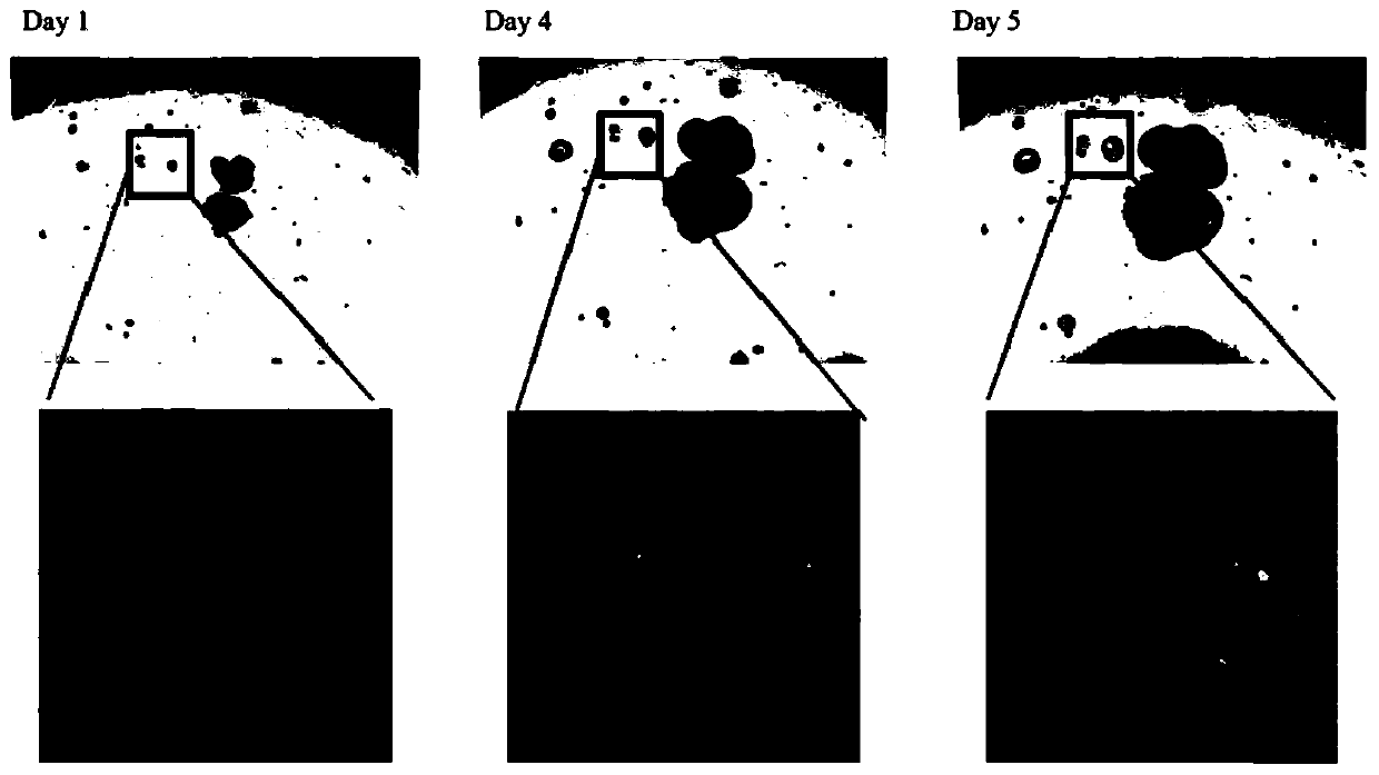 In vitro culture method of cancer type organs