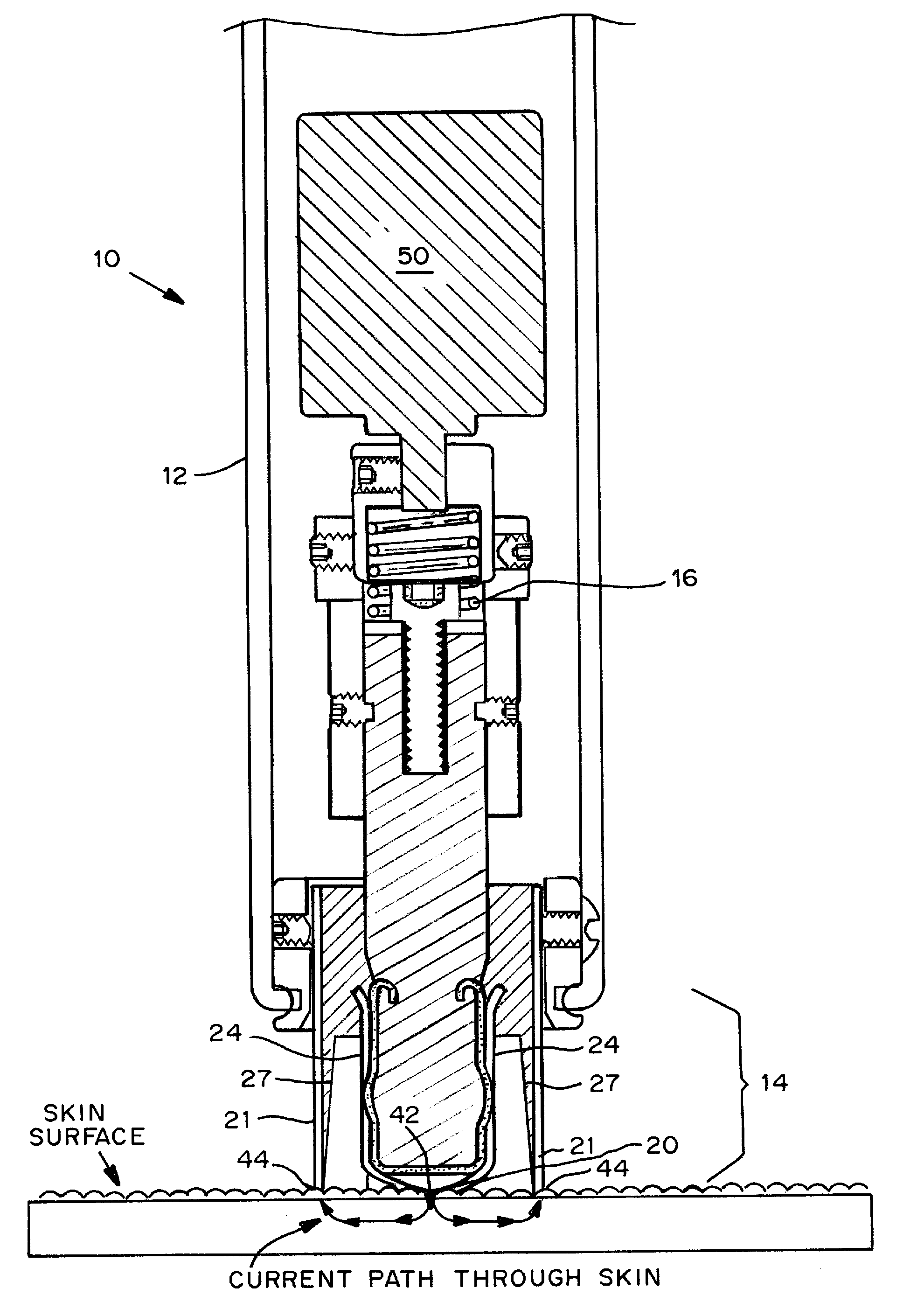 Skin permeation device for analyte sensing or transdermal drug delivery