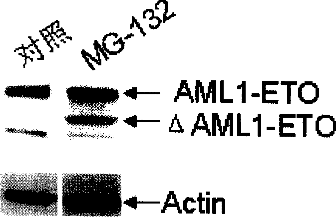 Application of compound MG 132 in preparation of medicine for treating leucocythemia